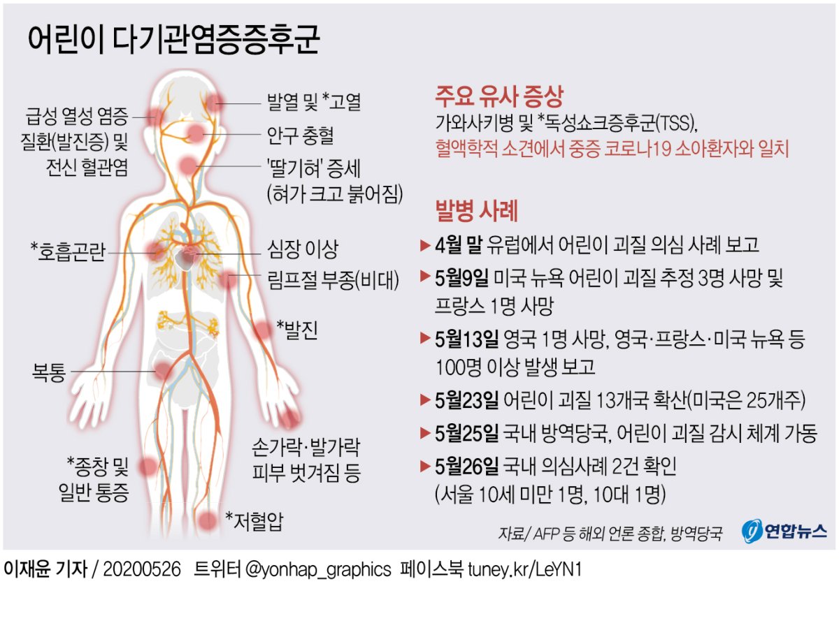 어린이 다기관염증증후군 '불안불안'…"면역 과잉반응 추정" - 2