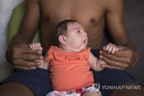 카니발 시즌 앞둔 브라질…"축제 기간 소두증 대확산 우려" - 2