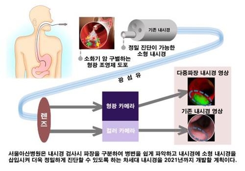 "소화기질환 정밀진단"…차세대 내시경 개발 본격화 - 2