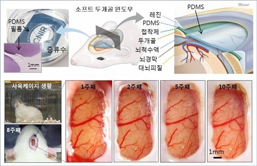 "살아있는 동물의 뇌 관찰하고 수술도 가능" - 2