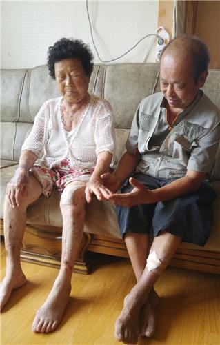 "日서 피폭돼 3대가 고통…70년 세월 외면당했다" - 3