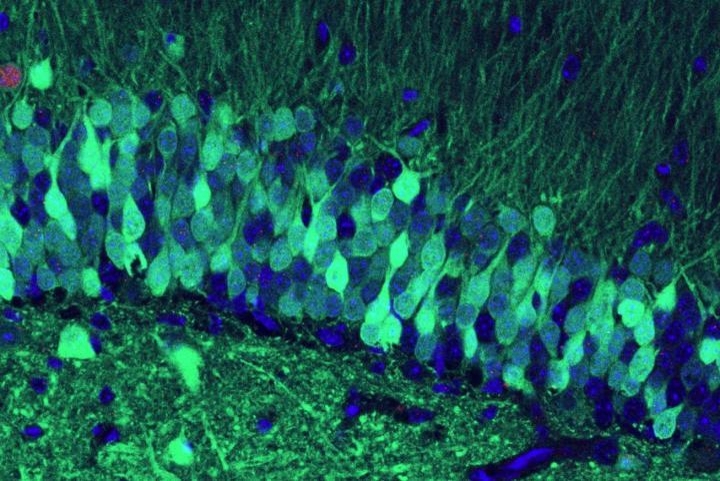 두려운 기억으로 활성화된 생쥐의 해마 세포(밝은 녹색)