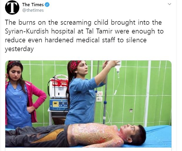 백린탄 피폭으로 의심되는 부상을 입은 쿠르드 소년