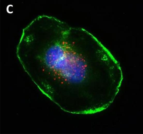 개의 방광암 세포에서 형광을 내는 EGF(홍색)·세포핵(청색)·액틴 세포골격(녹색)