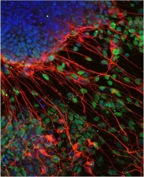 T-박스 인자가 없이 줄기세포에서 분화한 신경세포
