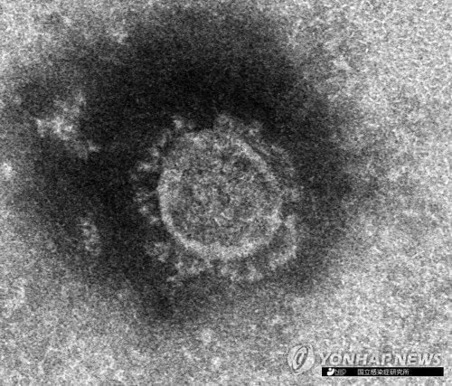 일본 국립감염증 연구소가 분리해 낸 신종 코로나바이러스의 전자현미경 사진