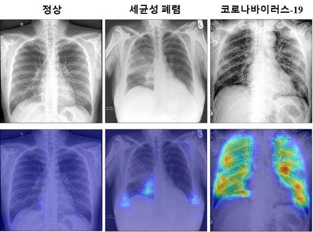 코로나19 확률 분포 특징 지도
