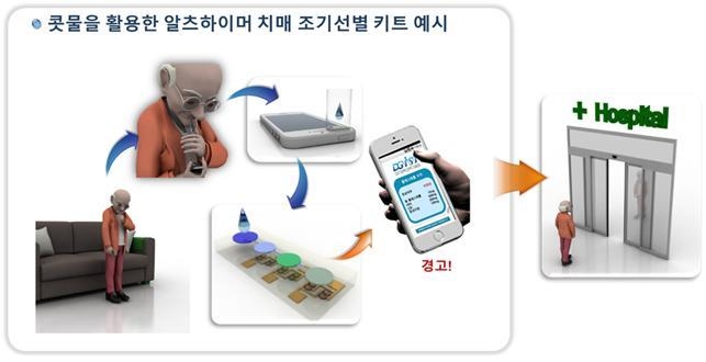 콧물 활용한 알츠하이머성 치매 조기선별 키트 활용 예시