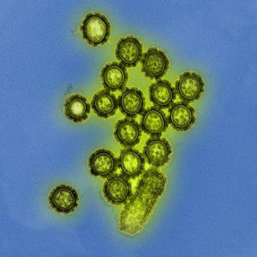 유행 빈도가 높은 H1N1형 인플루엔자 바이러스 