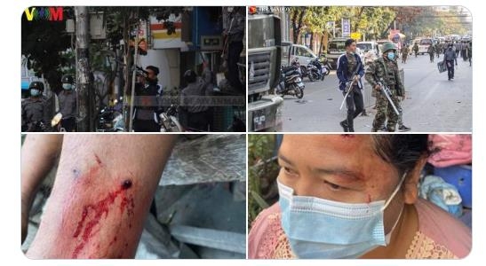 "고무탄·새총에 맞아 피 흘리는 미얀마 시민들"