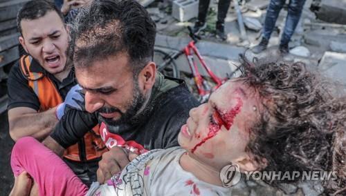 공습으로 다친 가자지구 주민