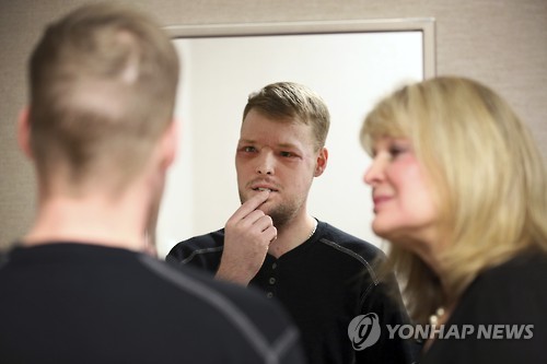 이식 후 얼굴 살펴보는 샌드니스