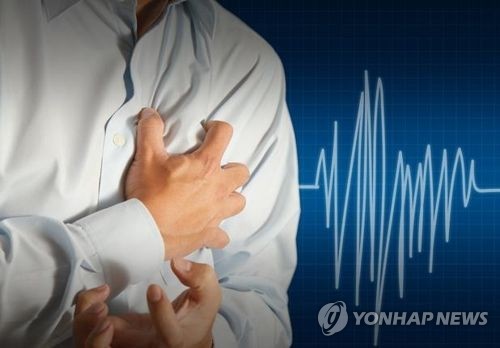 심근경색