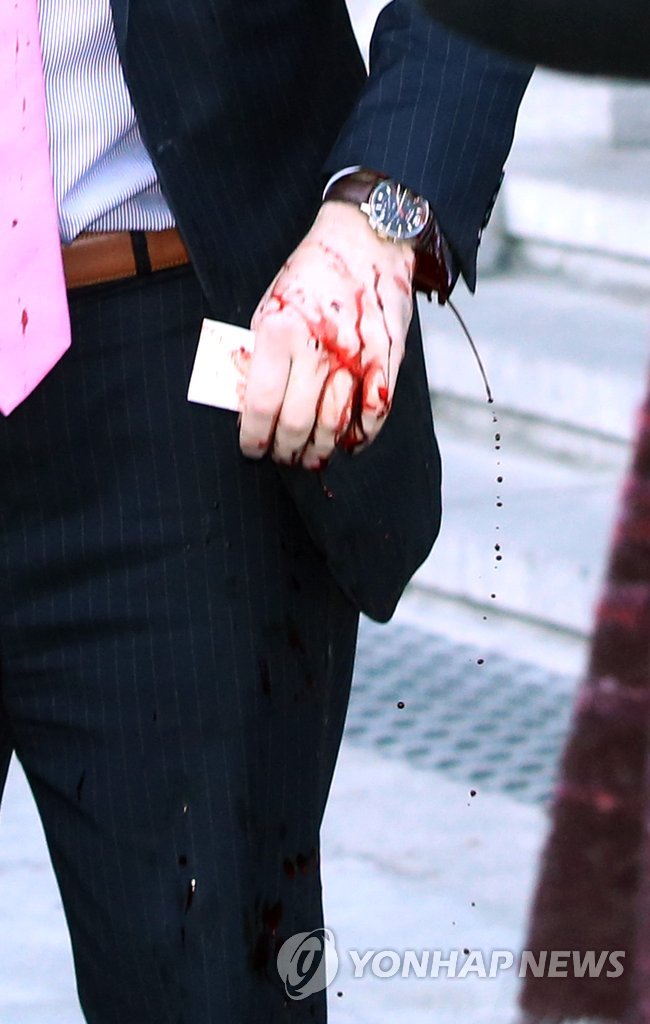 피 쏟아져 나오는 리퍼트 대사의 왼쪽 팔목(김주성 기자)