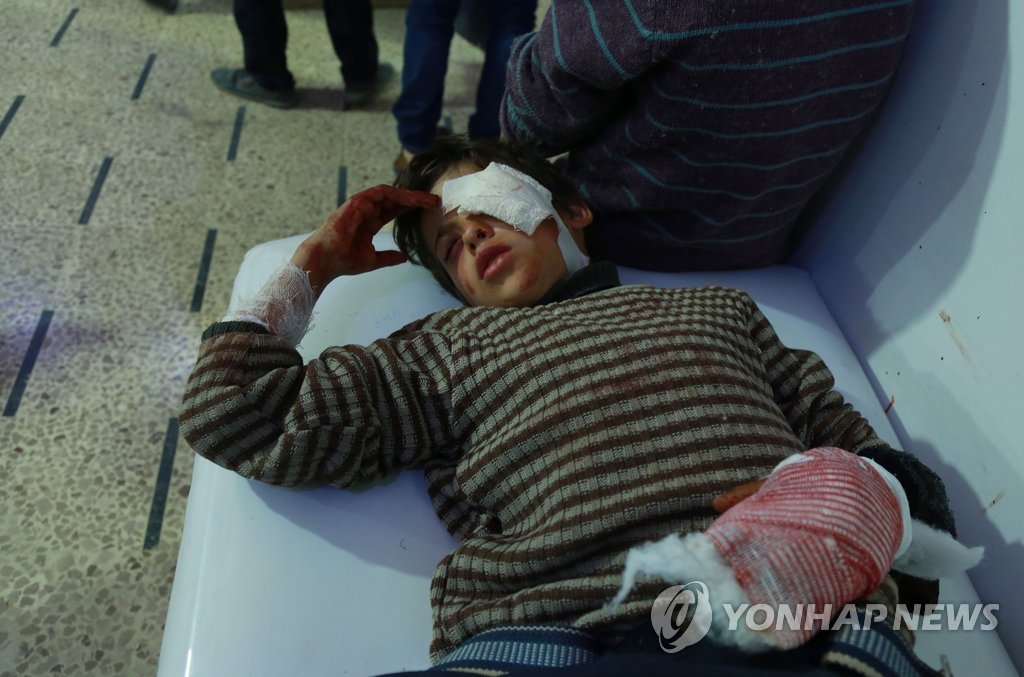 부상당한 시리아 동구타 어린이