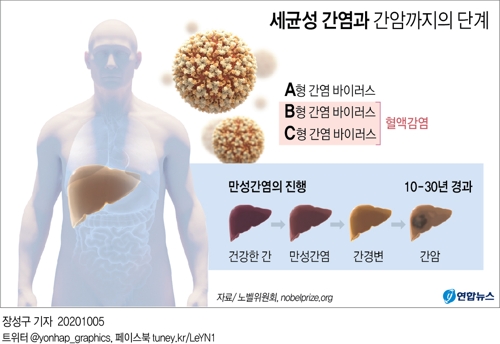 [그래픽] 세균성 간염과 간암까지의 단계