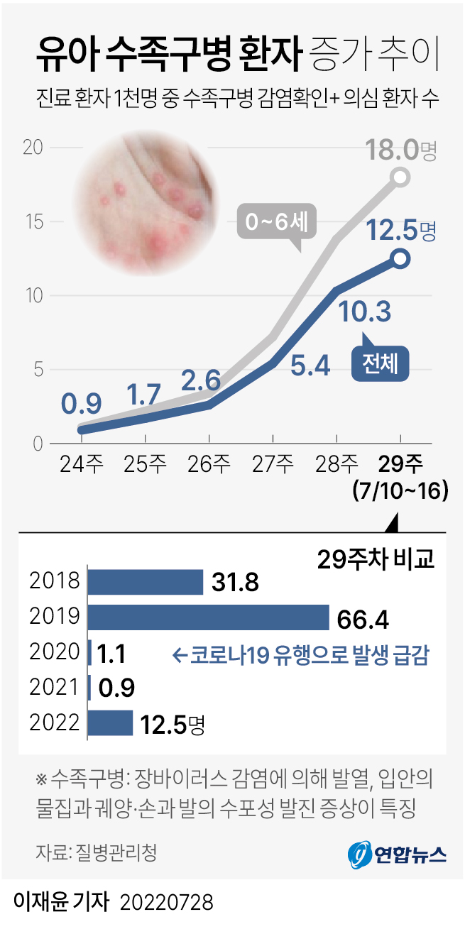 [그래픽] 유아 수족구병 환자 증가 추이