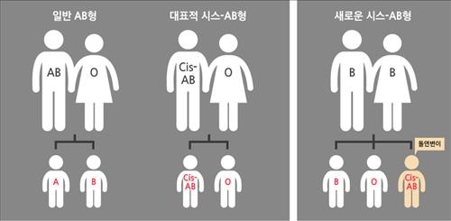 "B형 부모 사이서 AB형 딸"…'돌연변이 AB형' 첫 발견 - 2