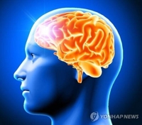 "하루 10시간 이상 근무하는 날 많을수록 뇌졸중 위험↑"