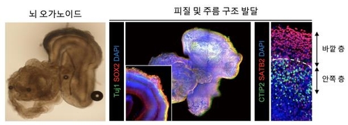 3D image analysis of brain organoids developed by the research team