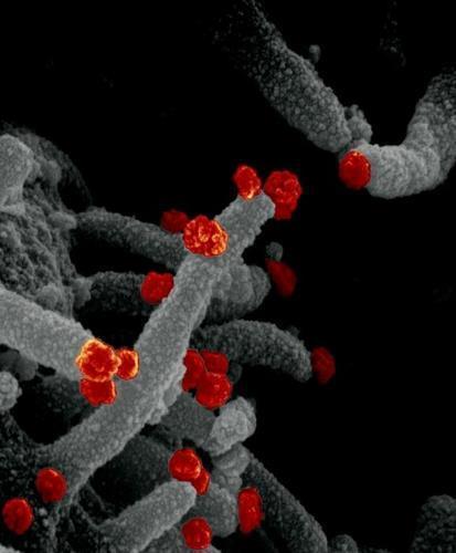 배양 세포에서 빠져나오는 신종 코로나바이러스(적색). 