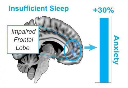 잠이 부족하면 불안 수위도 높아진다.