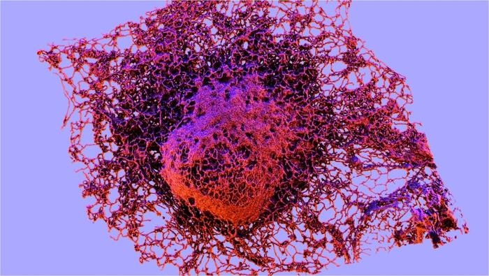 암세포에 퍼진 세포질 망상 구조(적색)