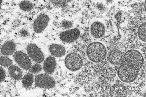 원숭이두창 바이러스