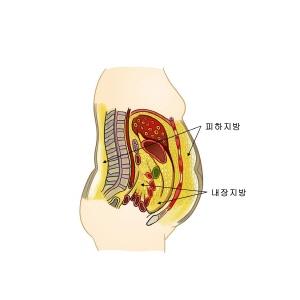 내장지방