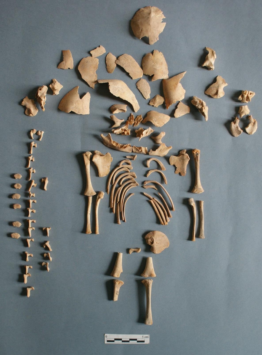 스페인 알토 델라 크루즈 철기시대 유적에서 발굴된 다운증후군 태아 유골