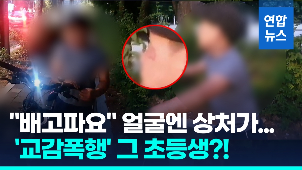 [영상] "배고파! 엄마가 때렸어요"…'자전거 절도범' 잡고보니 그 아이? - 2