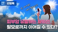 [리빙톡] 피부암 유발하는 자외선, 탈모로까지 이어질 수 있다?
