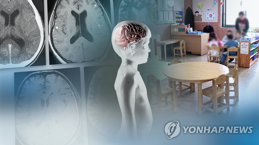 감기와 증상 비슷한 수막염 '조심'