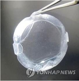 일본서 줄기세포 각막 이식…"일상생활 가능 시력회복"
