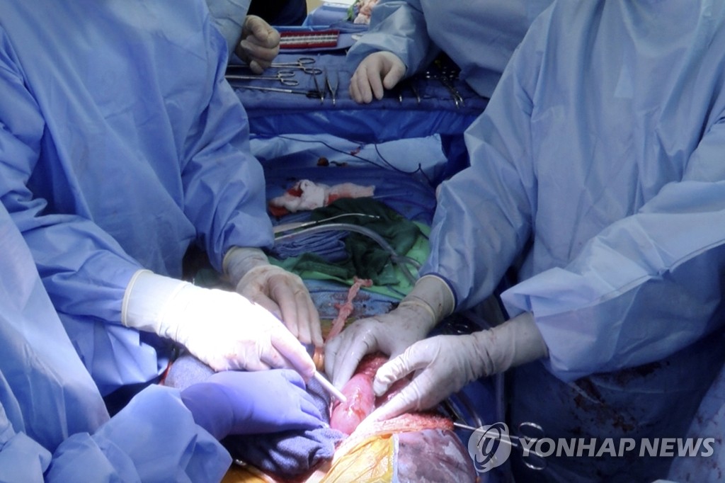 미 앨라배마대 의료진, '돼지 신장 인체 이식' 수술